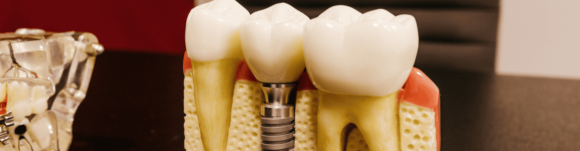 Cosmetic Dental Services