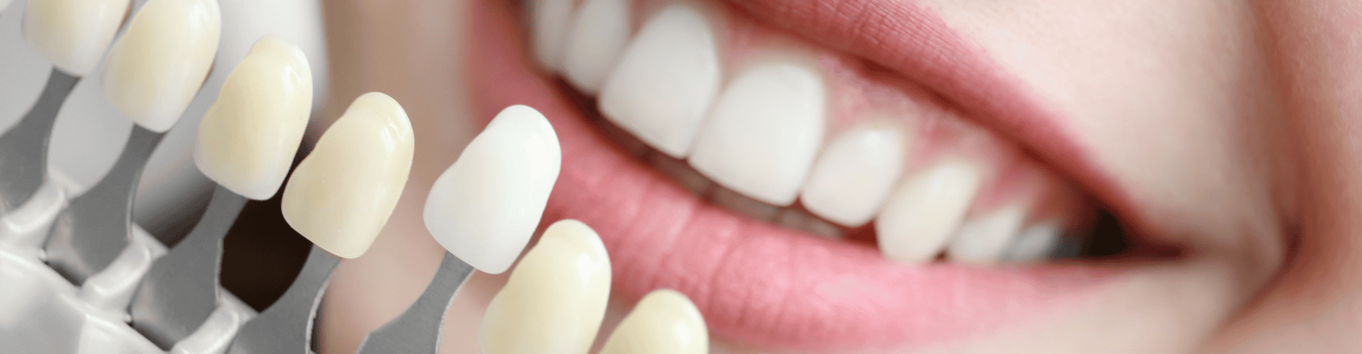 Cosmetic Teeth Whitening