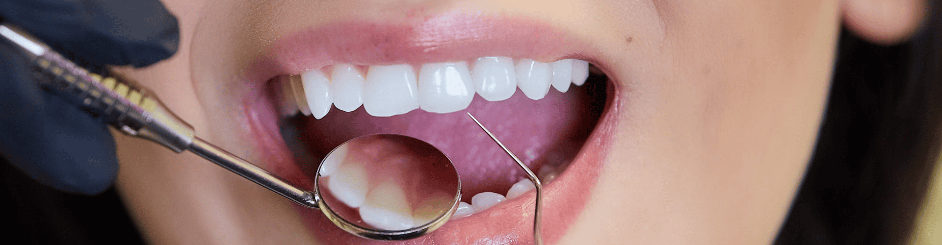 Importance of Regular Dental Check-Ups